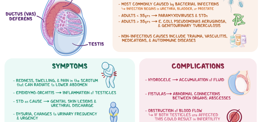 Inflammation of the epididymis and testicles &#8211; causes, diagnosis, treatment. What are the complications of inflammation?