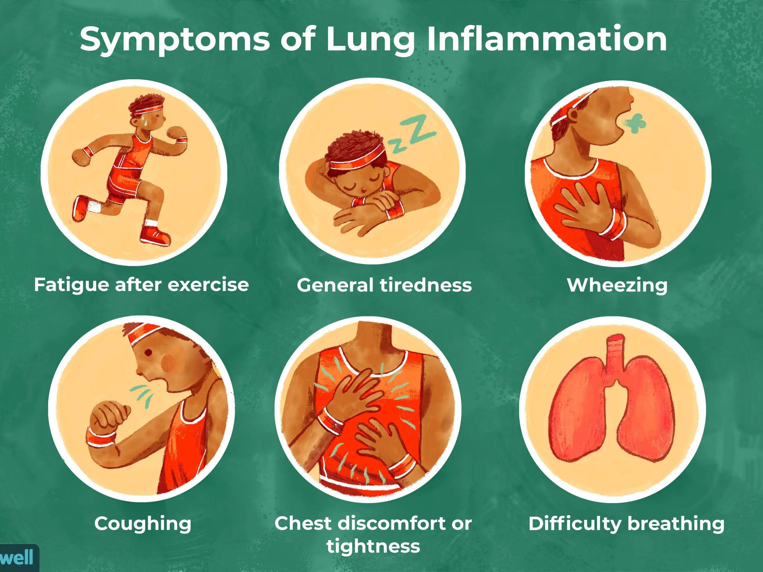 Inflammation of the respiratory tract &#8211; causes, symptoms, home pre-medical help