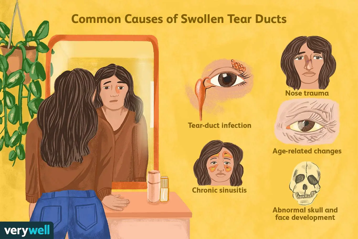 Inflammation of the tear ducts in adults and children &#8211; how to treat?