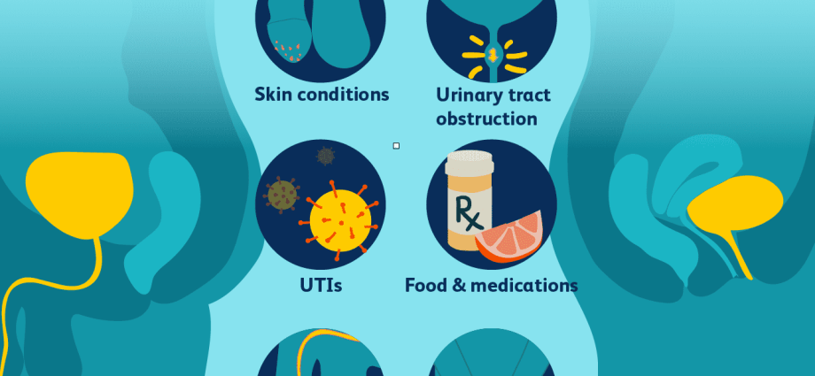 Inflammation of the urethra and bladder &#8211; symptoms, causes, treatment, home remedies