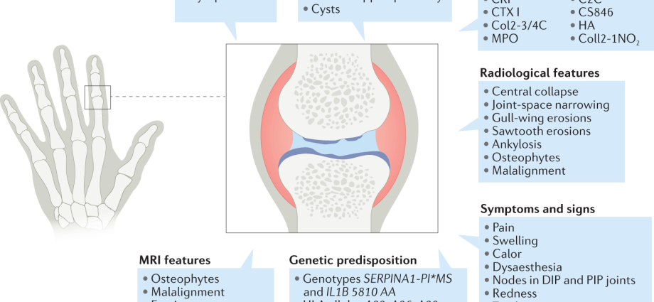 Inflammatory osteoarthritis