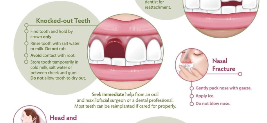 Injuries of the face and mouth