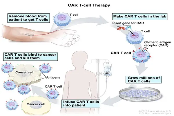 Innovative CAR-T Cells therapy