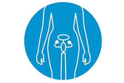 Insidious ovarian cancer