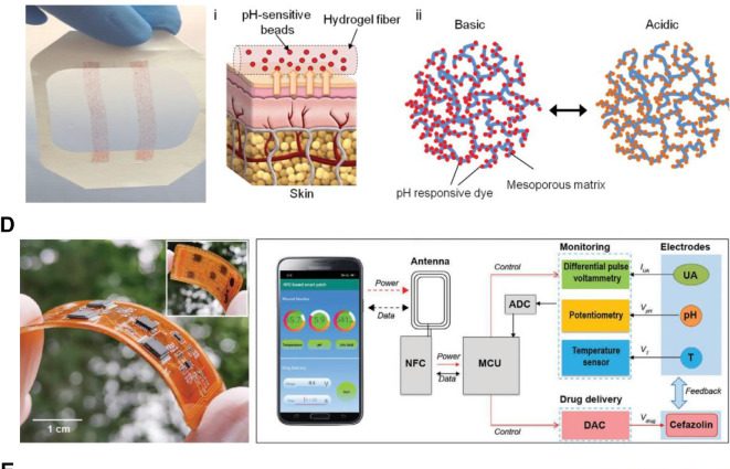 Intelligent seams facilitate wound healing