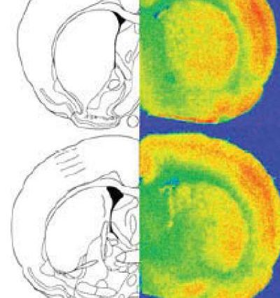 Intensive therapy leaves its mark on the psyche