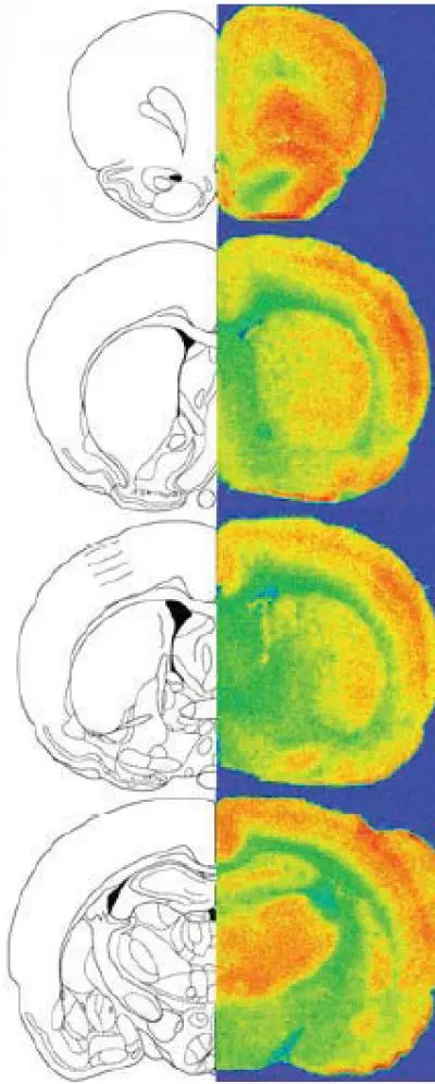 Intensive therapy leaves its mark on the psyche