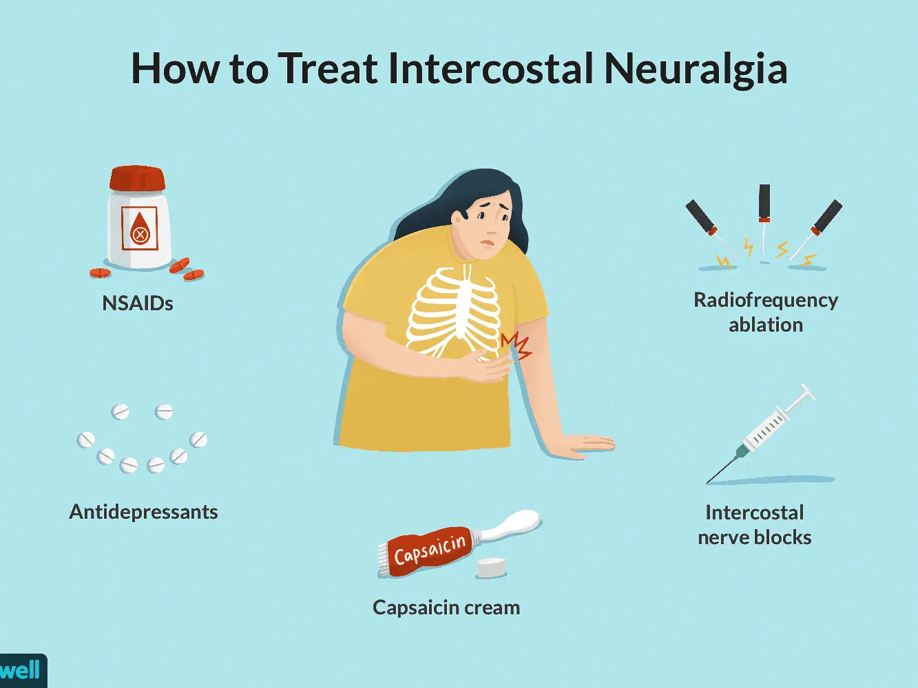 Intercostal neuralgia &#8211; causes, symptoms, diagnosis, treatment