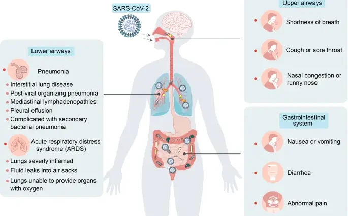 Intestinal complications and COVID-19. The symptoms of stomach flu may appear before the other symptoms