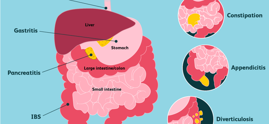 Intestinal pain &#8211; causes, diagnosis and treatment