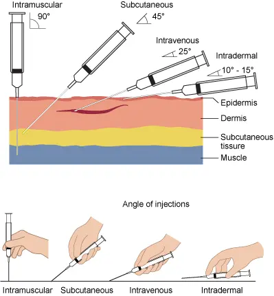 Intramuscular and subcutaneous injection &#8211; what is it? Manner of execution and threats