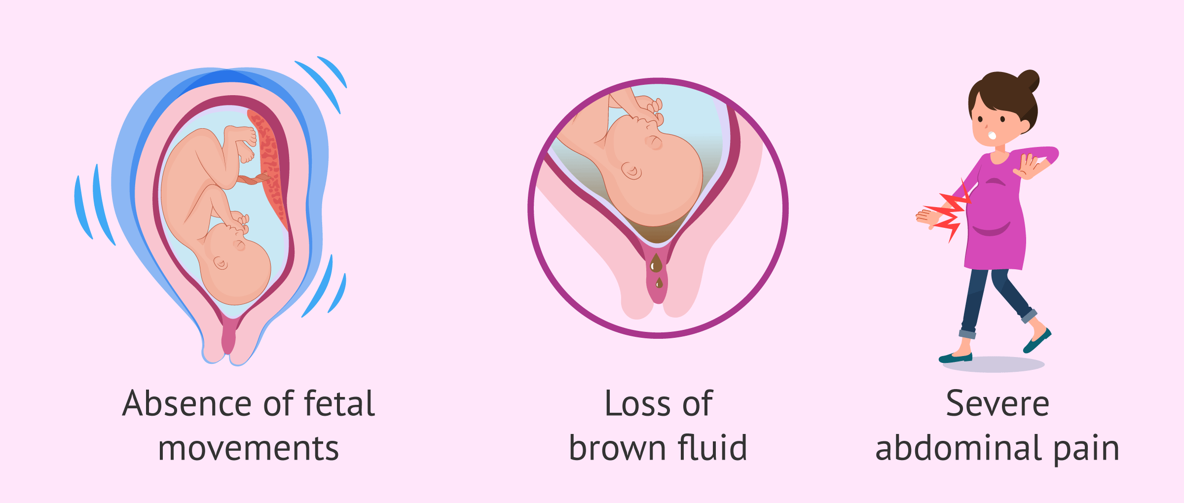 intrauterina-distrofija-ploda-vzroki-in-simptomi-kako-zdraviti