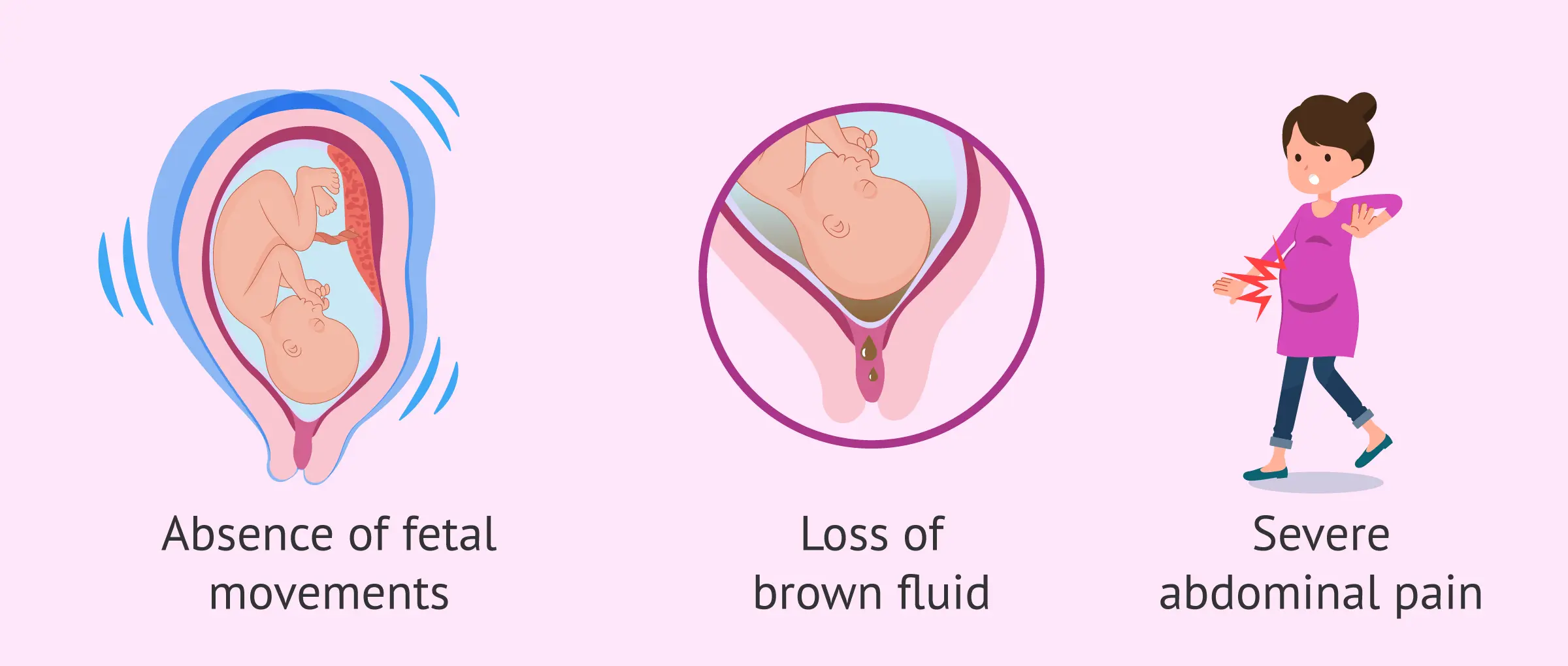 Intrauterine dystrophy of the fetus &#8211; causes and symptoms. How to treat fetal dystrophy?