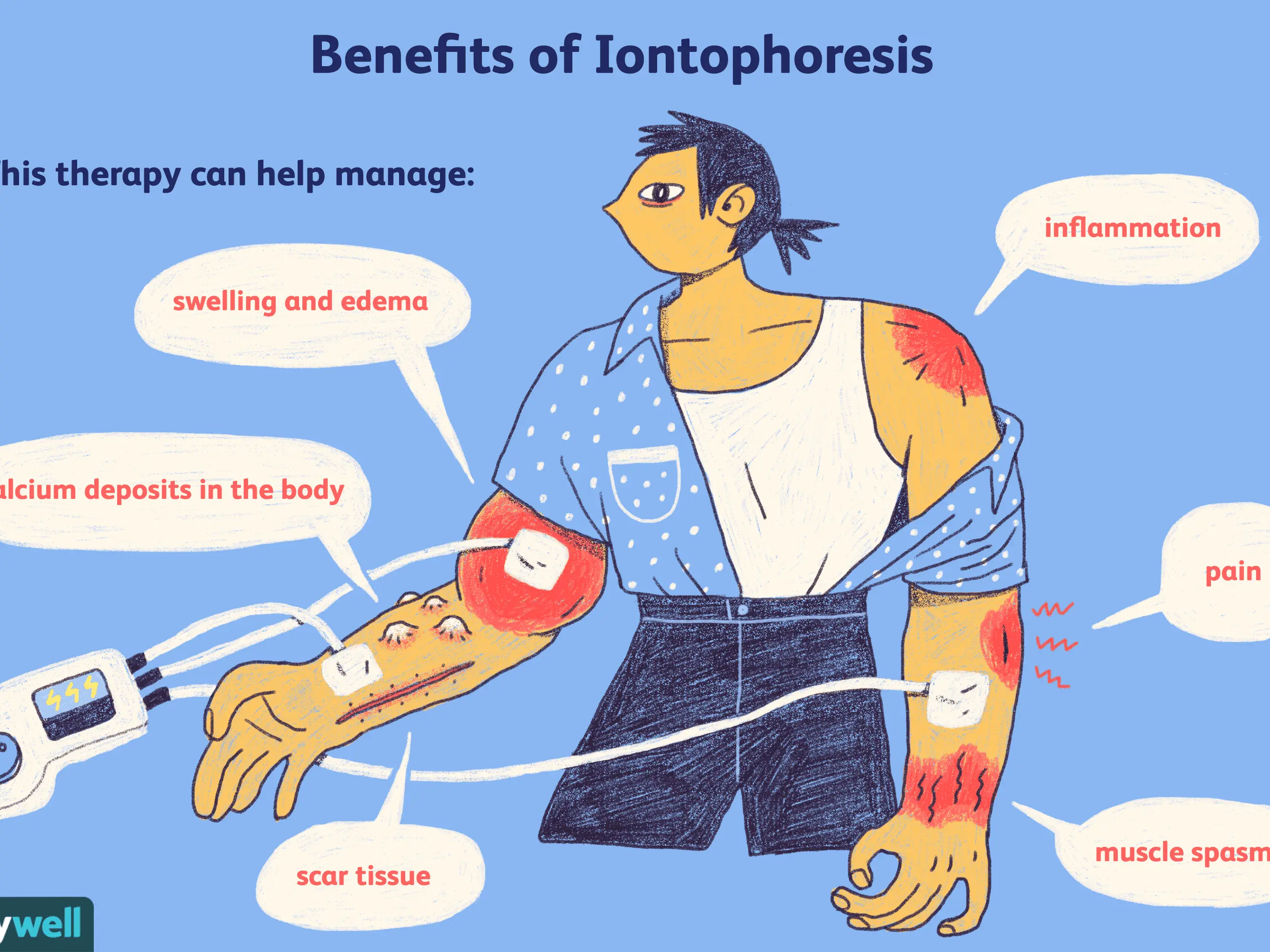 Iontophoresis &#8211; indications, course, contraindications, opinions. What is iontophoresis?