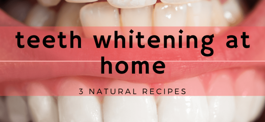 Is it possible to achieve a white smile at home?