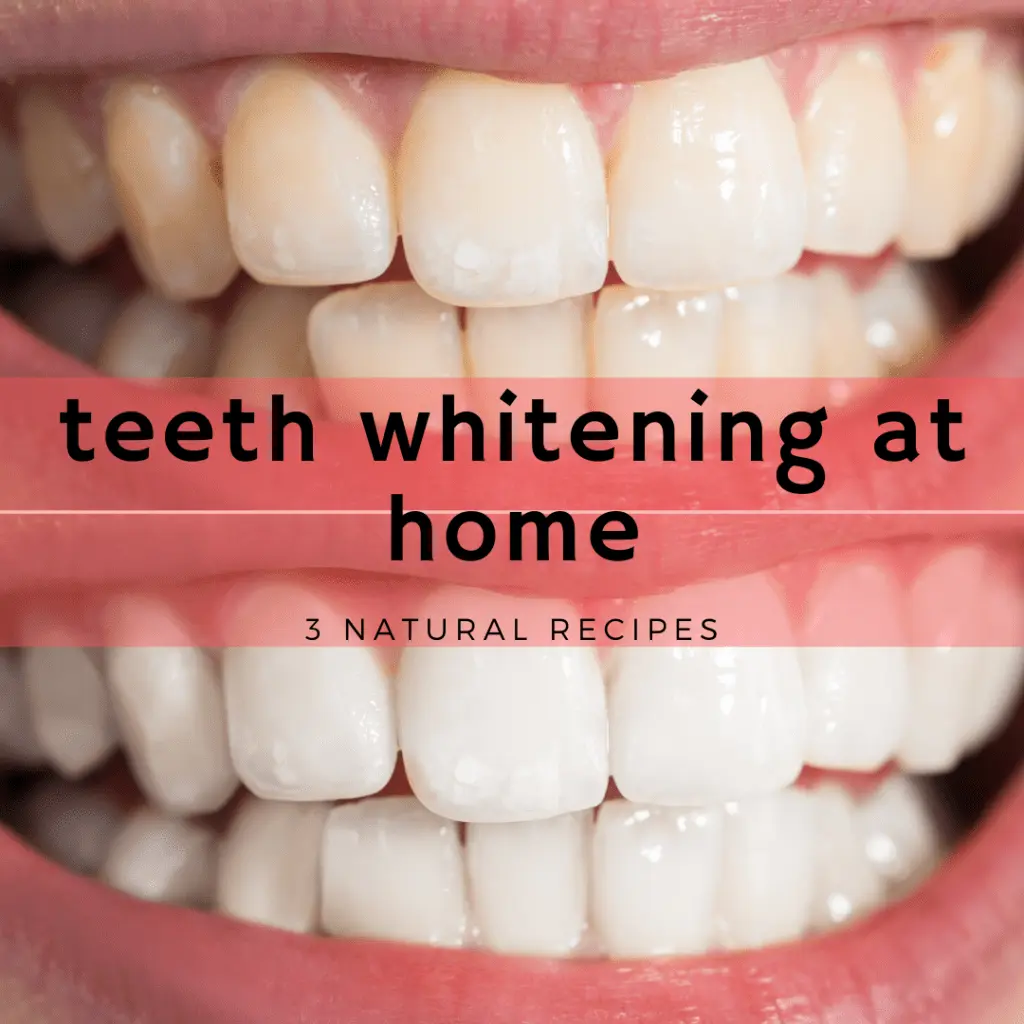 Is it possible to achieve a white smile at home?