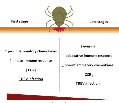 Is it tick-borne encephalitis? Five key symptoms