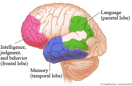 Is there a way to protect the brain from dementia? You can do more than you think