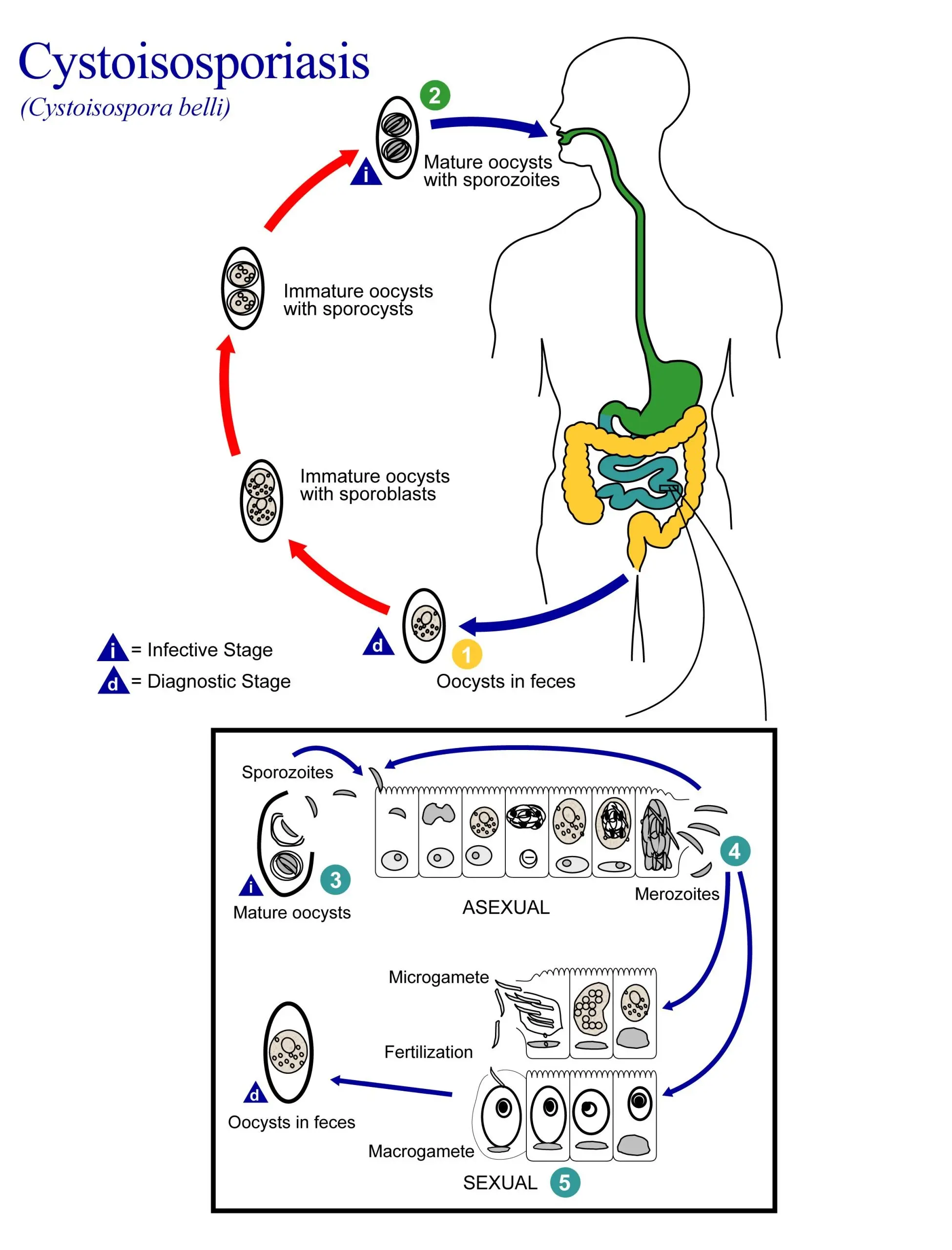 Isosporosis &#8211; causes, symptoms, diagnosis. How to treat isosporosis?