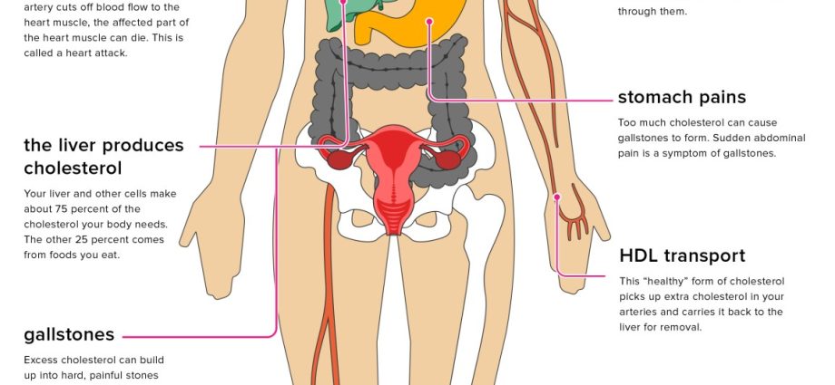 It silently wreaks havoc on the body. What happens when you have high cholesterol?