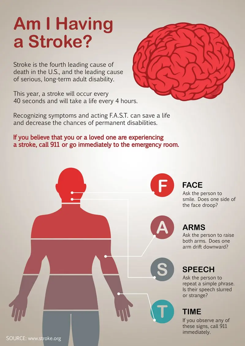 It touches 80 thousand. Poles every year. How do you recognize the symptoms of a stroke?