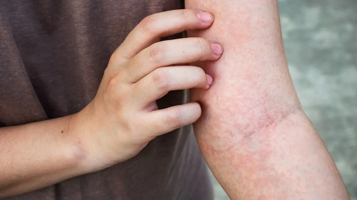 Itching is an important sign from the body. See what itching means and how to treat it