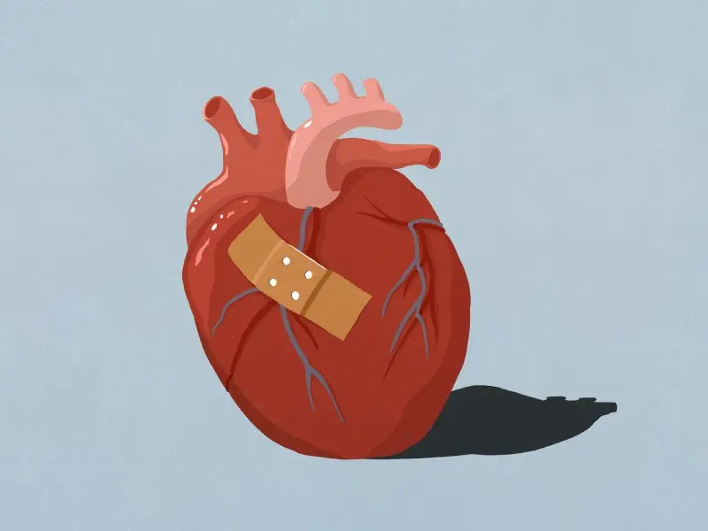 Its symptoms are similar to a heart attack. More women with &#8220;broken hearts&#8221;