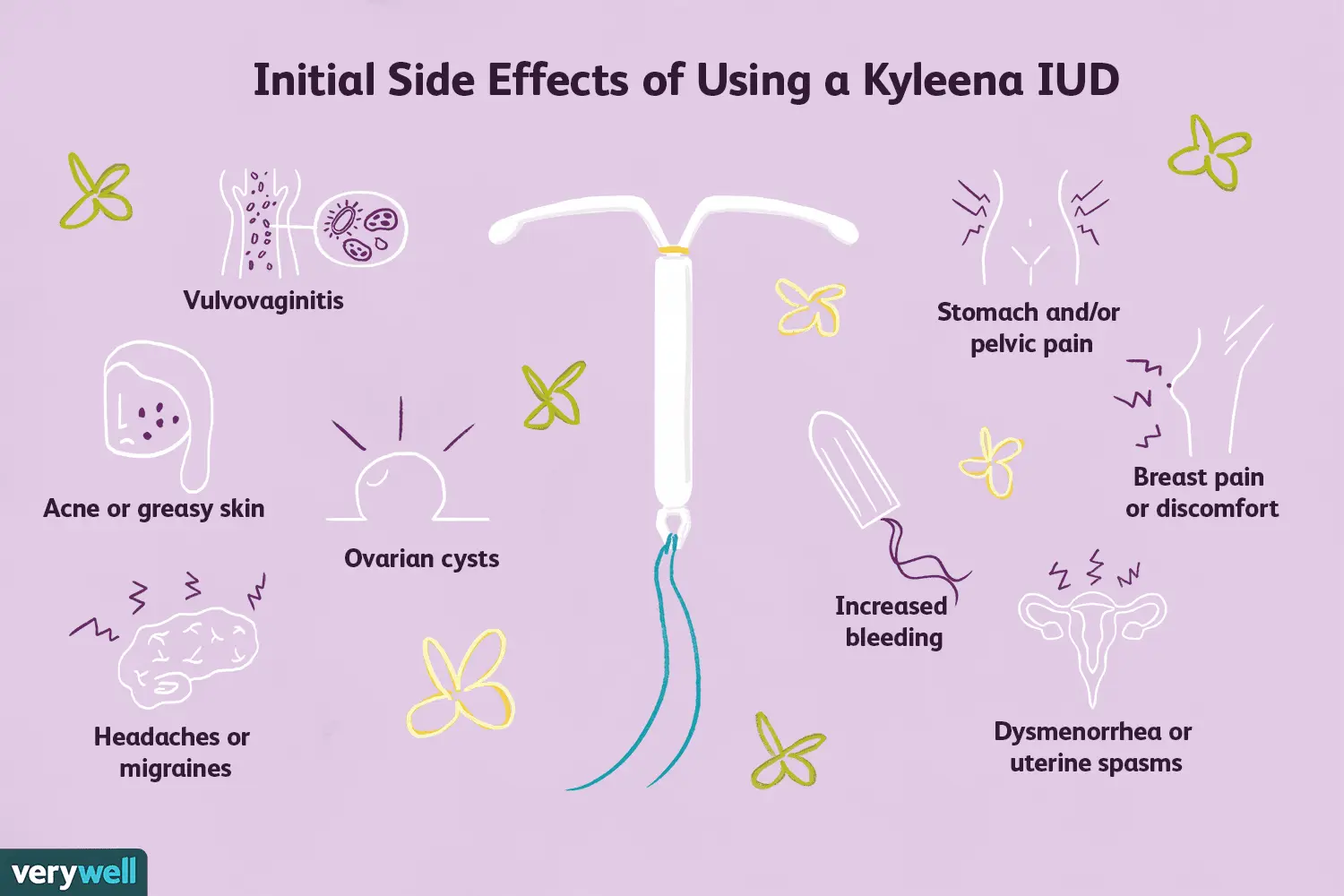 IUD &#8211; types, side effects, price