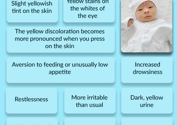 Jaundice in a newborn &#8211; characteristics and causes