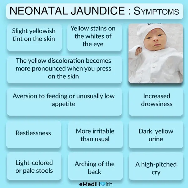 Jaundice in a newborn &#8211; characteristics and causes