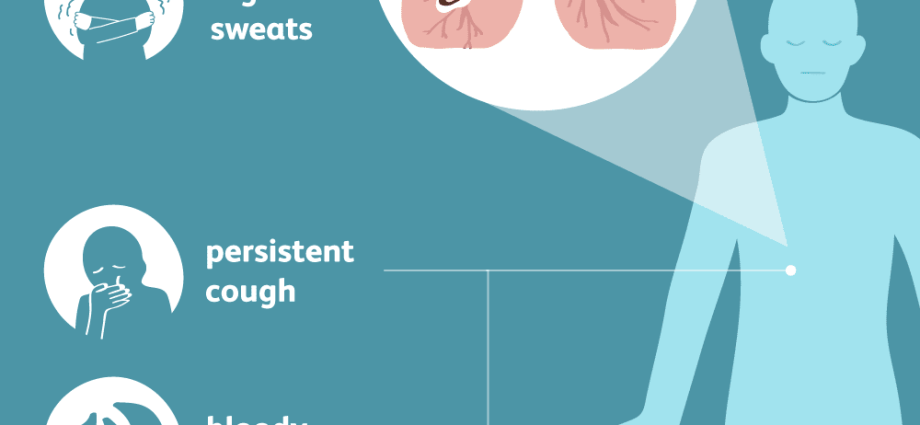 Joint tuberculosis &#8211; symptoms, diagnosis and treatment