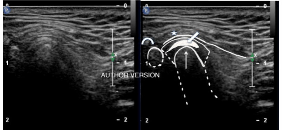 Joint ultrasound &#8211; indications and the course of the examination