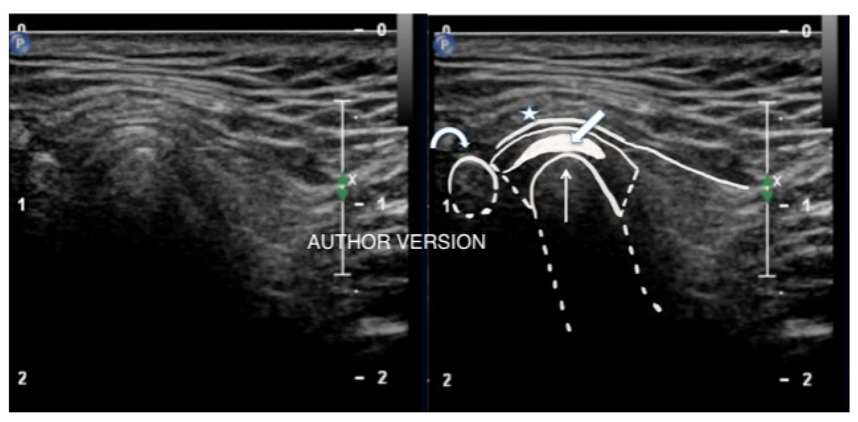 Joint ultrasound &#8211; indications and the course of the examination