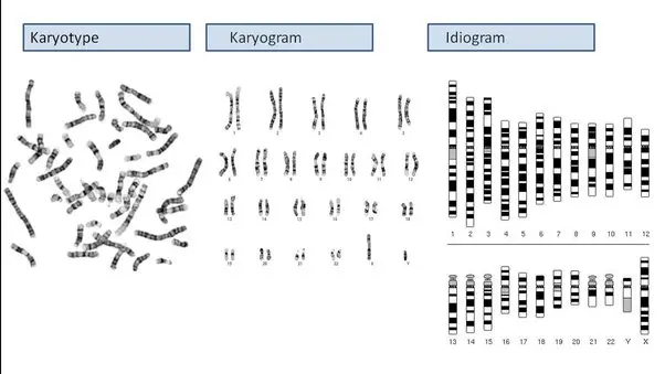 Karyotype &#8211; what is it? Course and price of the karyotype test