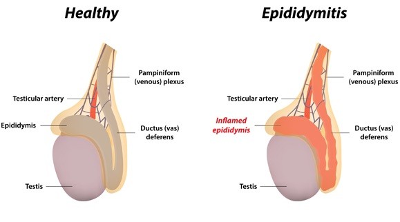 Kernels &#8211; structure and functions. The most common diseases of the testicles