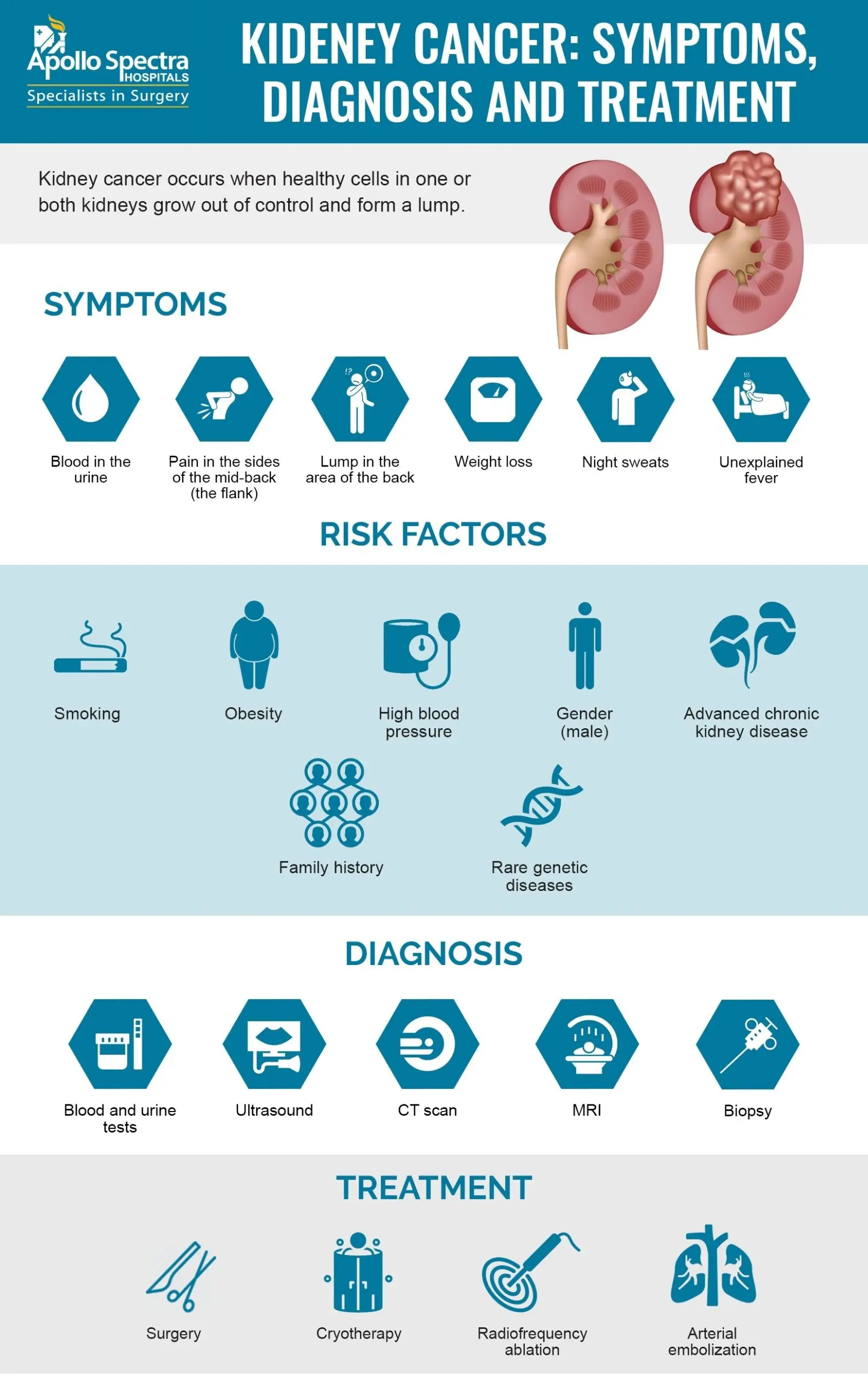 Kidney cancer &#8211; causes, symptoms, treatment