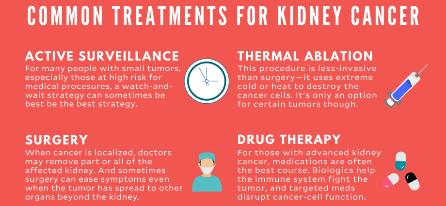 Kidney cancer &#8211; risk factors, treatment. Kidney cancer detected too late