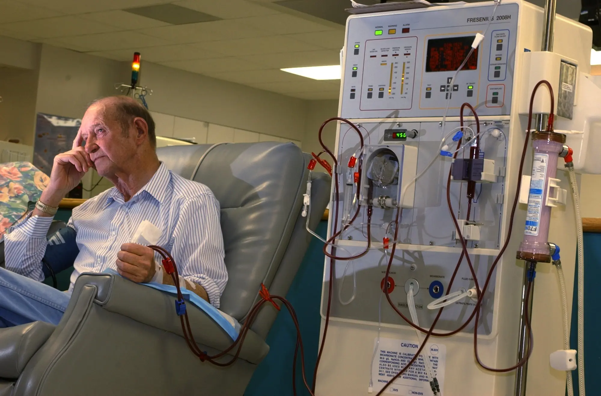 Kidney disease &#8211; a silent epidemic that is not talked about
