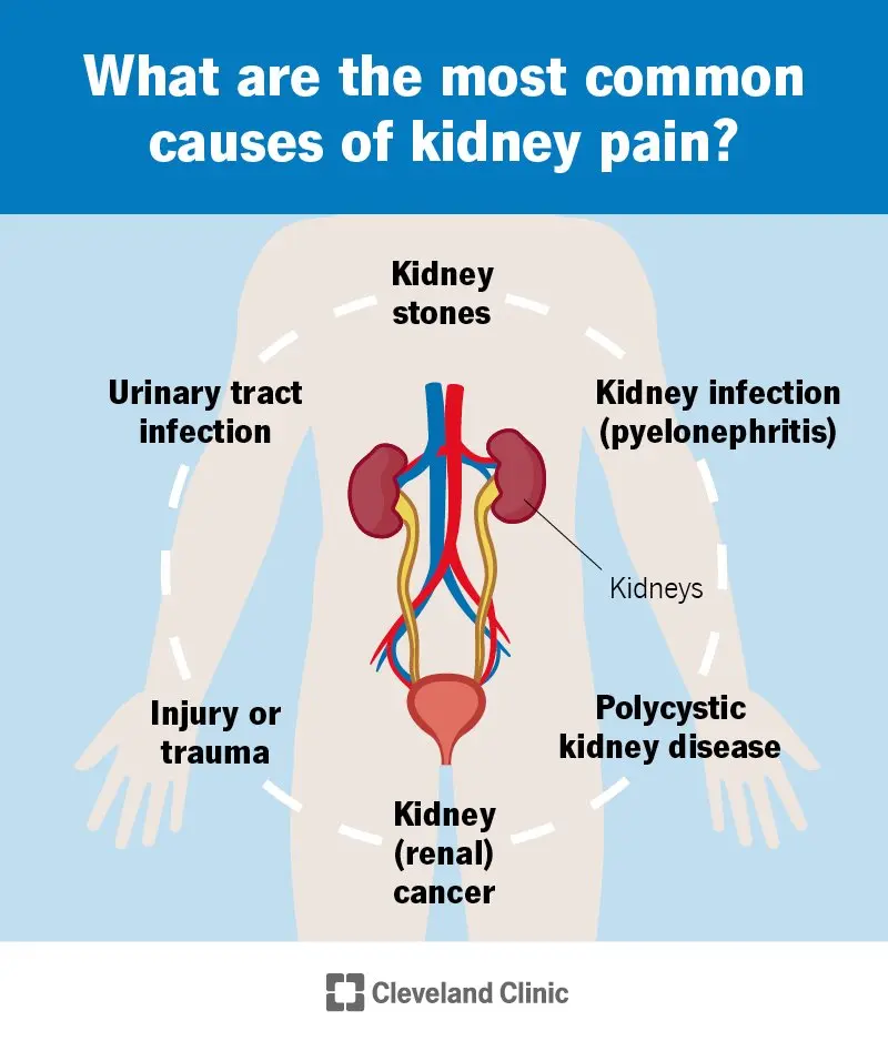 Kidney pain &#8211; causes, diagnosis, treatment. What diseases cause kidney pain?