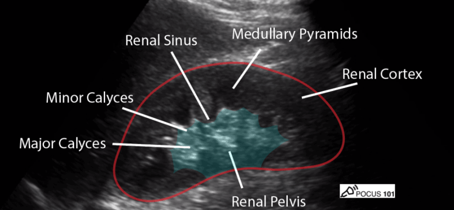 Kidney ultrasound &#8211; how to interpret the results?