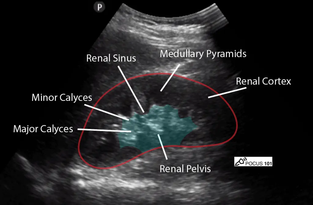 Kidney ultrasound &#8211; how to interpret the results?