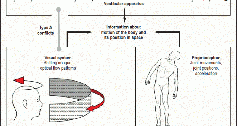 Kinetosis, or motion sickness