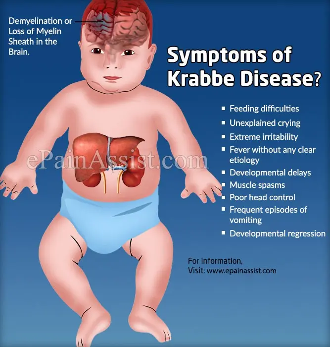 Krabbe&#8217;s disease &#8211; symptoms, causes, treatment, prognosis