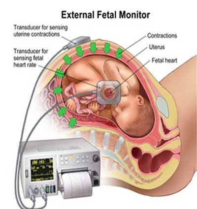 KTG &#8211; what is it and when to do it? How is CTG performed?