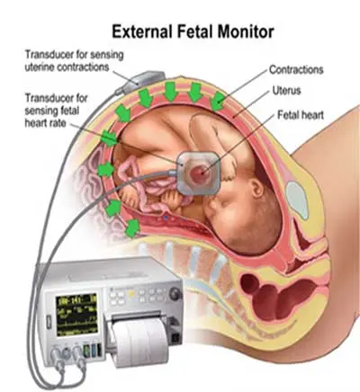 KTG &#8211; what is it and when to do it? How is CTG performed?