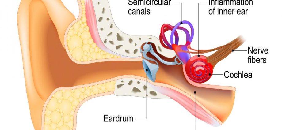 Labyrinthitis &#8211; Causes, Symptoms and Treatment