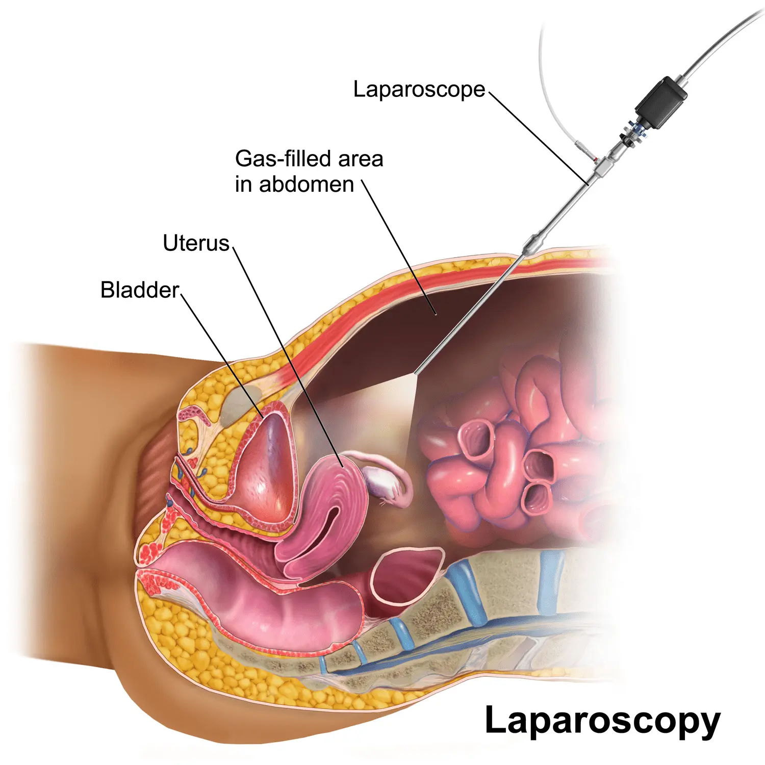 Laparoscopy &#8211; what is this procedure