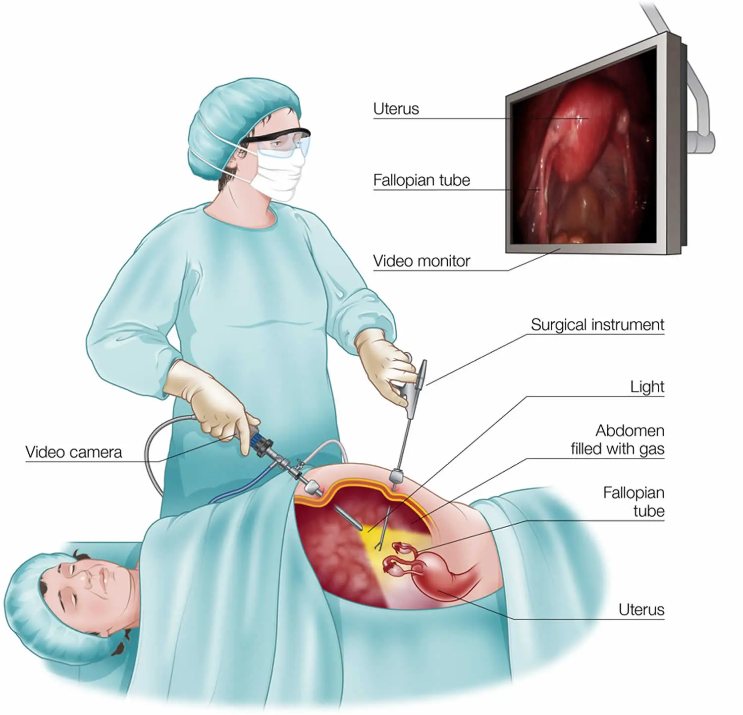 Laparotomy &#8211; course, preparation, possible complications. When should you decide on the procedure?