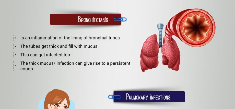 Laryngeal cough &#8211; causes, symptoms, treatment