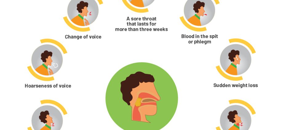 Laryngeal neoplasms &#8211; first symptoms, tests, treatment